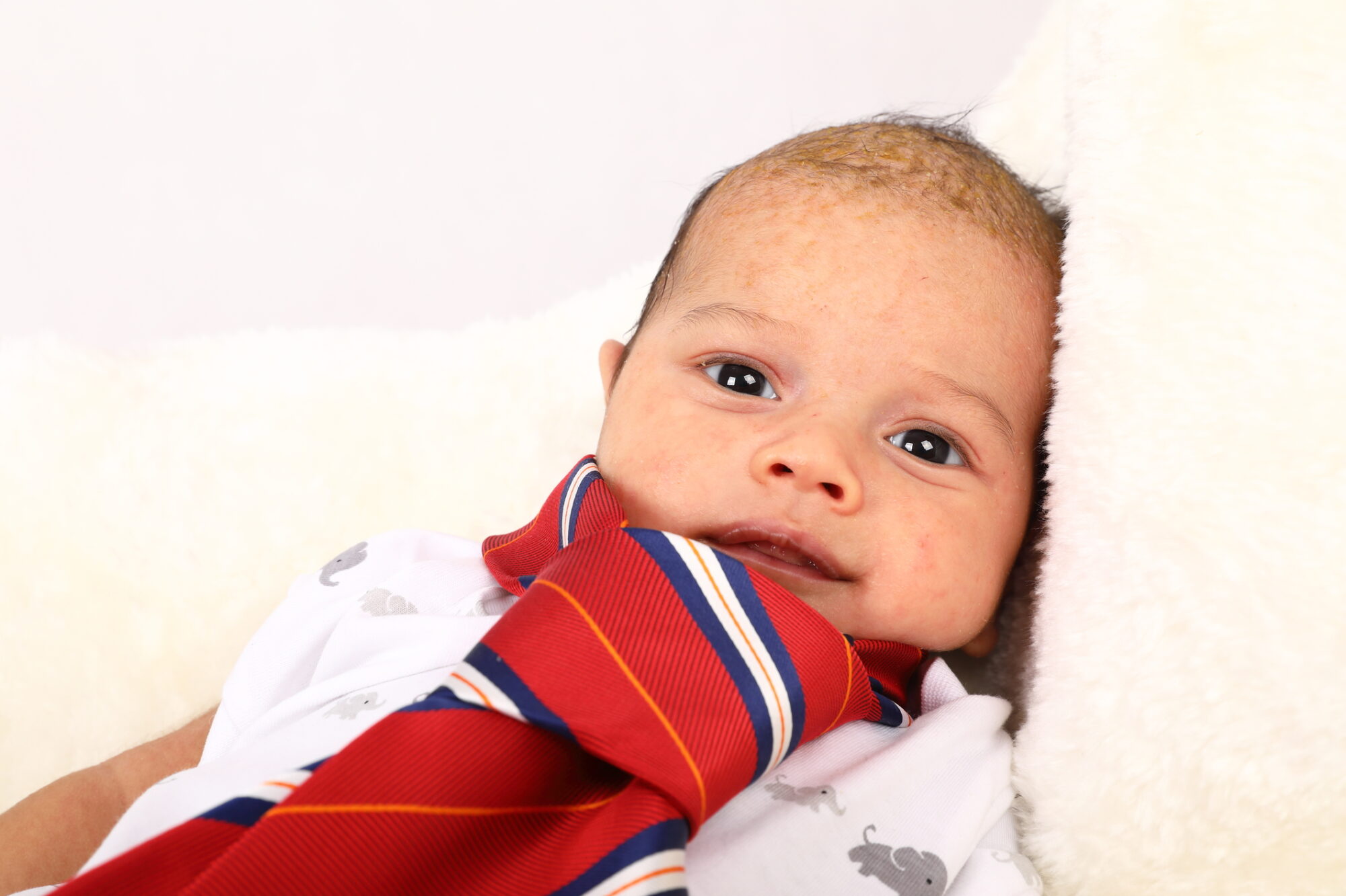 Lip Ties Union Orthodontics + Pediatric Dentistry